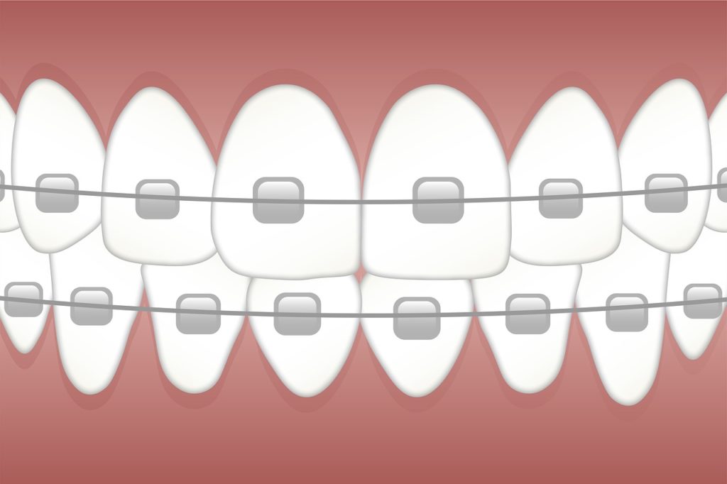 שיניים קדמיות