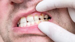 המדריך לתביעת פיצויים טיפול שיניים רשלני